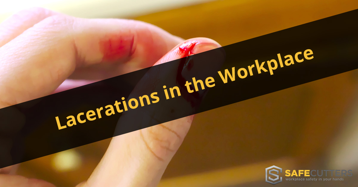 Lacerations In The Workplace